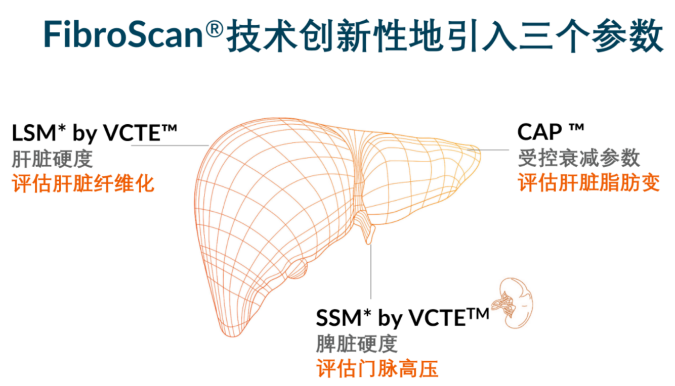 喜訊！FDA擴大了FibroScan?在肝臟綜合管理中的應(yīng)用范圍
